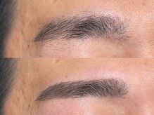 アンベリール(Embellir)/眉毛beforeafter