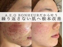 アエオボンヌール(A.E.O BONHEUR)