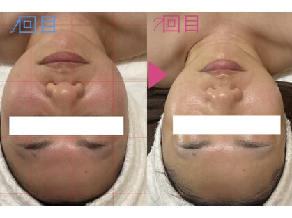 グレイスシャイン(GraceShine)の写真