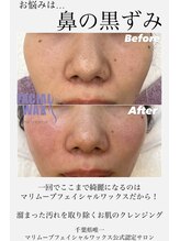 エリス(ELISSE)/フェイシャルワックス