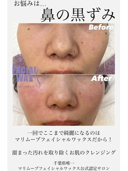 エリス(ELISSE)/フェイシャルワックス