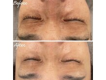 クラティス 塩尻店(CRATIS)/エクソソーム導入