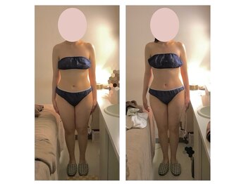 アクア エステティコ 亀有(ACQUA estetico)/痩身　脂肪燃焼　中半身　6回　