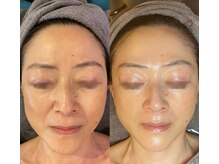 ラリマ(La-lima)の雰囲気（エステでも美しく！鏡をみることが嬉しくなる素肌になりませんか）