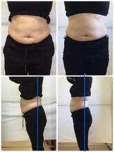 きれいなからだ/ボディインパクトを腰・お腹へ