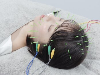 ハリカ 大阪心斎橋店(HARIKA)/初めての方におすすめの美容鍼