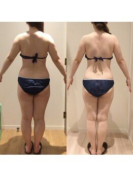 アユアランリンク 札幌店/20代/約3ヵ月/ブライダル/背面