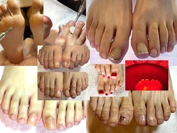 ビサンテ サロンの写真/《足自爪ケア/+角質ケア/+自爪育成,爪保護コーティング,角質育成ケア[足裏肌質改善],FootGel,手ケア》人気!
