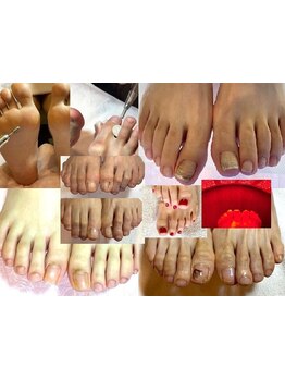 爪の悩みを解消できる（ケア含む）