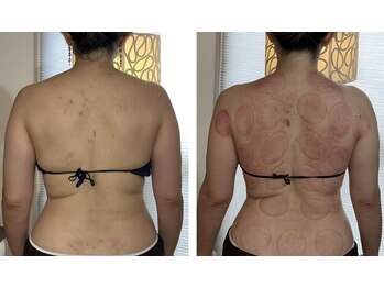 ウラヤス 恵比寿(Urayasu)/月1ペースの３回目50代