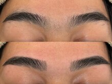 アンベリール(Embellir)/眉毛beforeafter