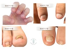 リケアネイル(Re:care nail)の雰囲気（あらゆる爪のトラブルに対応◎キレイな爪を目指せます♪）