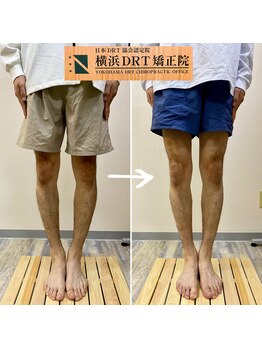 横浜DRT矯正院/O脚矯正