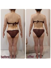 レイビューティー 一宮店(RAY+ Beauty)/筋膜リリース