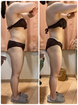 レイビス 仙台店(RAYVIS)/贅肉撃退痩身！