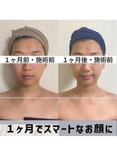 お顔の研究所/ビフォーアフター写真♪