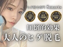 スマーツ(Smarts)