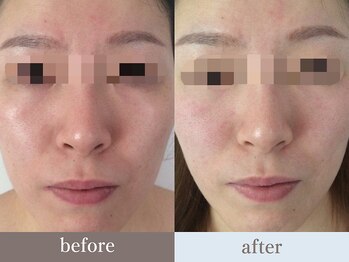 ビューティースタジオ韓美 銀座店/お客様のbefore/after