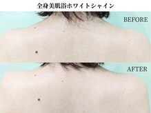 サンビ(SANBI)/ブライダルケアにもおすすめ◎