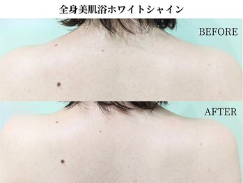 サンビ(SANBI)/ブライダルケアにもおすすめ◎