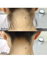 エース(ACE.)/うなじは後ろ姿の顔！！