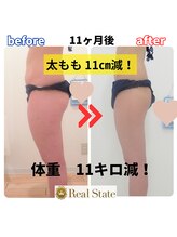 レアルステイト 御経塚店/太ももスッキリ♪