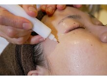 アンジェロ/【シミケア】