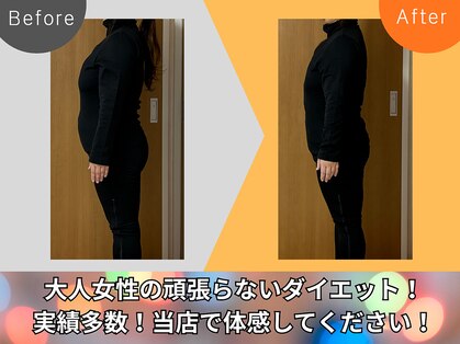 ヨサパーク ビリュウ(YOSA PARK Bellyu)の写真