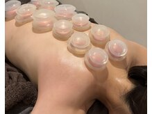 オリエンタル ルボワール(oriental Revoir)の雰囲気（肩こり　首こり　筋膜リリースカッピング　カッピング　デコルテ）