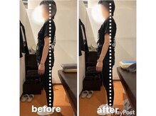 カワル整体 上通り院/反り腰の癖