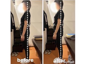 カワル整体 上通り院/反り腰の癖