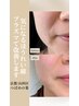 【人気No.1】40代からの老け顔改善プログラム体験 ¥36,000→¥18,800