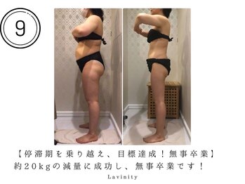 ラヴィニティ 南越谷店(Lavinity)/約-20kg！停滞期を乗り越え卒業