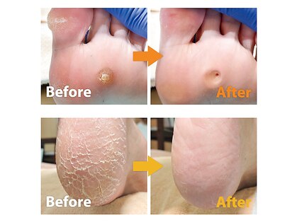 巻き爪補正店 富山店の写真