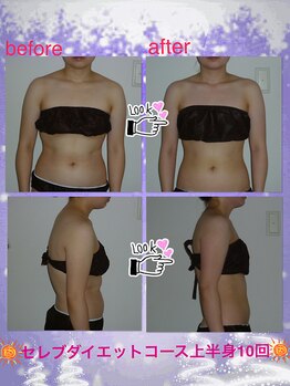 ボディグロス 梅田店(BODY GLOSS)/セレブダイエット