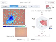 アリエス/肌解析機　iPas
