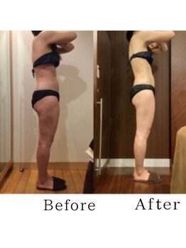 銀座レイア/【痩身ビフォーアフター】