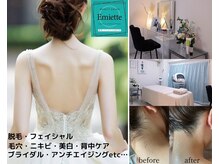 エミエット(Emiette)