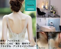 エミエット(Emiette)