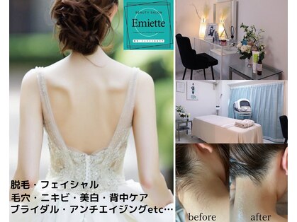 エミエット(Emiette)の写真