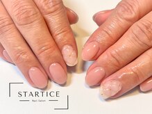 スターチス(STARTICE)/定額シンプルコース