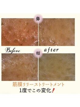 グラサヴォーグ 金沢店/一度で毛穴もふっくら♪
