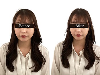 整体と美容鍼 無名/Before&After【心斎橋/南船場】