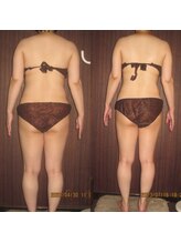 エクラ(Eclat)/Eclatの痩身★BeforeAfter5