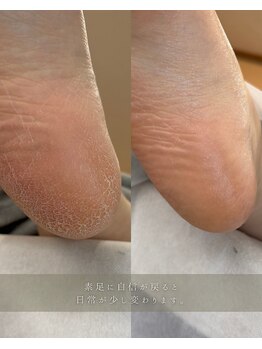 フットミー(foot mii)/