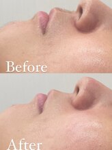 ラクシー 船橋(luxssy)