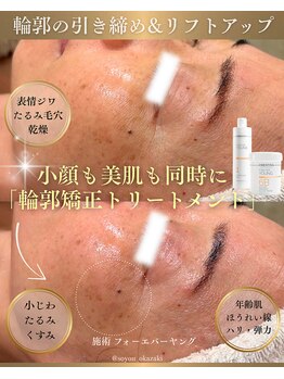 ソユ(SOYOU)/施術* フォーエバーヤング