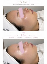 ケセラ(Quesera)&nbsp;人気No.1 白玉肌管理