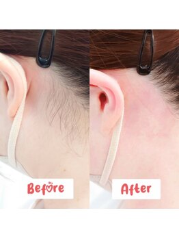 メローワックス 仙台東口店(MELLOW WAX)/【ワックス脱毛】魅せるうなじ