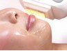 【お顔脱毛】気になる産毛をなくして美肌効果UP★ ¥6,000→￥3,000